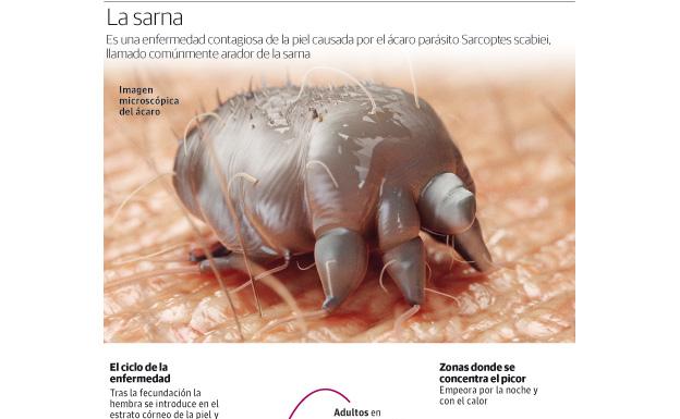 Humana escabiosis es que la